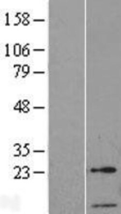 Novus Biologicals™ GTF2A2 Overexpression Lysate