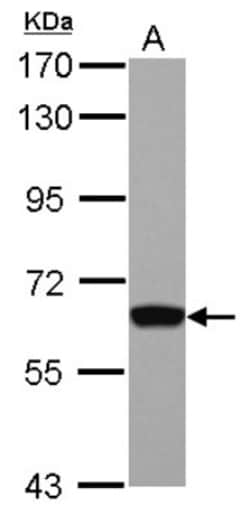 GTF2H1 Antibody, Novus Biologicals 0.1mL; Unlabeled:Antibodies, Polyclonal