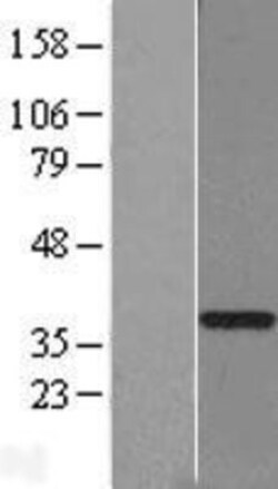 Novus Biologicals&trade;&nbsp;GTF2H3 Overexpression Lysate