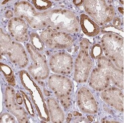 GTF2H3 Antibody, Novus Biologicals 0.1mL; Unlabeled:Antibodies, Polyclonal