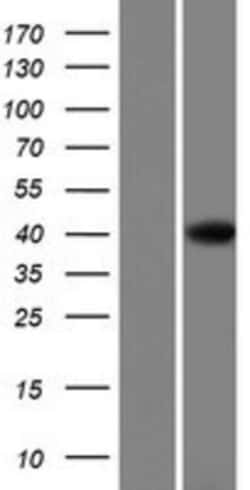 Novus Biologicals&trade;&nbsp;GTF3A Overexpression Lysate