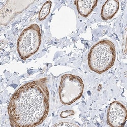 GTF3C2 Antibody, Novus Biologicals 25 &mu;L; Unlabeled:Antibodies, Polyclonal