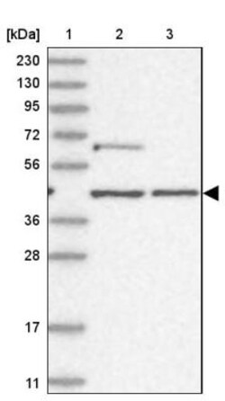 GTF3C2 Antibody, Novus Biologicals 25 &mu;L; Unlabeled:Antibodies, Polyclonal