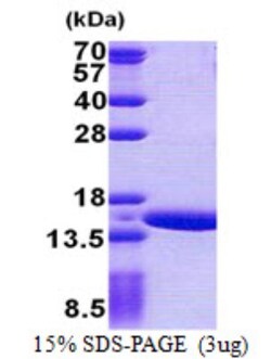 Novus Biologicals&trade;&nbsp;Recombinant Human Gtlf3b His Protein