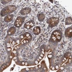 GTP binding protein era homolog Antibody, Novus Biologicals 0.1mL; Unlabeled:Antibodies,