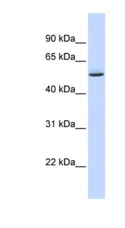 GTPBP10 Antibody, Novus Biologicals 100&mu;L; Unlabeled:Antibodies, Polyclonal