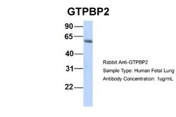 GTPBP2 Antibody, Novus Biologicals 100&mu;L; Unlabeled:Antibodies, Polyclonal