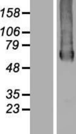 Novus Biologicals&trade;&nbsp;GTPBP2 Overexpression Lysate