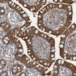 GTPBP2 Antibody, Novus Biologicals:Antibodies:Primary Antibodies