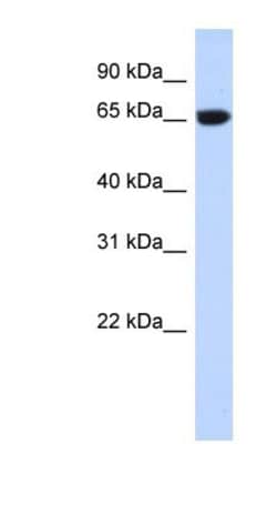 GTPBP2 Antibody, Novus Biologicals 100&mu;L; Unlabeled:Antibodies, Polyclonal