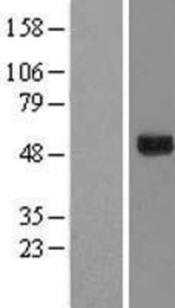 Novus Biologicals&trade;&nbsp;GTPBP3 Overexpression Lysate