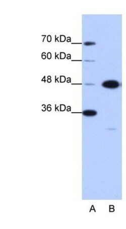 GTPBP9 Antibody, Novus Biologicals 0.05mg; Unlabeled:Antibodies, Polyclonal
