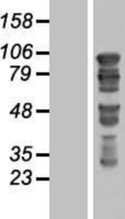 Novus Biologicals&trade;&nbsp;GTSE1 Overexpression Lysate