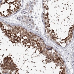 GTSF1 Antibody, Novus Biologicals:Antibodies:Primary Antibodies