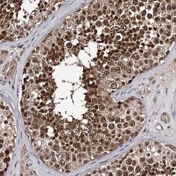 GTSF1 Antibody, Novus Biologicals 25 &mu;L; Unlabeled:Antibodies, Polyclonal