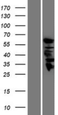 Novus Biologicals&trade;&nbsp;Guanine deaminase Overexpression Lysate
