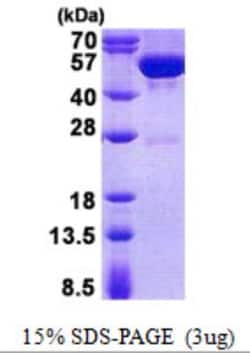 Novus Biologicals&trade;&nbsp;Recombinant Human Guanine deaminase His Protein