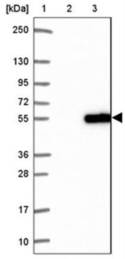 Guanine deaminase Antibody, Novus Biologicals 0.1ml | Buy Online | Novus Biologicals | Fisher Scientific
