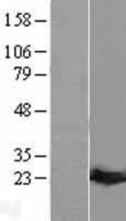 Novus Biologicals&trade;&nbsp;Guanylate kinase Overexpression Lysate