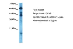 Guanylyl Cyclase beta 1 Antibody, Novus Biologicals 100 ul; Unconjugated:Antibodies,
