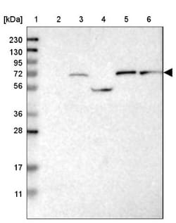 Guanylyl Cyclase beta 1 Antibody, Novus Biologicals 0.1mL; Unlabeled:Antibodies,