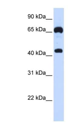 Guanylyl Cyclase beta 1 Antibody, Novus Biologicals 100 ul; Unconjugated:Antibodies,