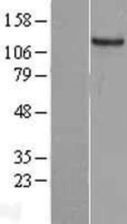 Novus Biologicals&trade;&nbsp;GUCY2C Overexpression Lysate