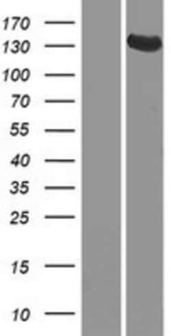 Novus Biologicals&trade;&nbsp;GUCY2D Overexpression Lysate