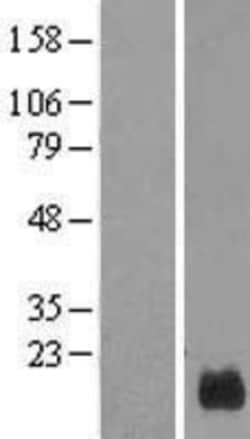 Novus Biologicals&trade;&nbsp;GUSBP5 Overexpression Lysate