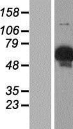 Novus Biologicals&trade;&nbsp;GYG2 Overexpression Lysate