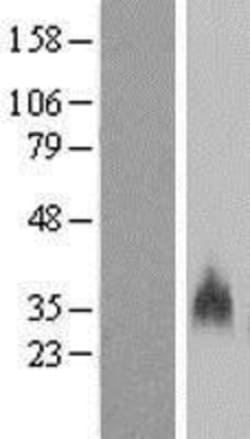 Novus Biologicals&trade;&nbsp;GYPB Overexpression Lysate