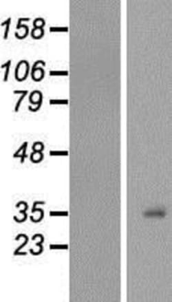 Novus Biologicals&trade;&nbsp;H1F0 Overexpression Lysate