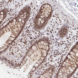 H1FX Antibody, Novus Biologicals:Antibodies:Primary Antibodies