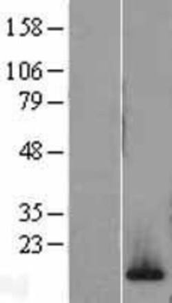 Novus Biologicals&trade;&nbsp;H2AFV Overexpression Lysate
