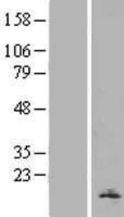 Novus Biologicals&trade;&nbsp;H2AFV Overexpression Lysate