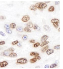 Histone H2AX Antibody, Novus Biologicals 0.1mg; Unlabeled:Antibodies, Polyclonal