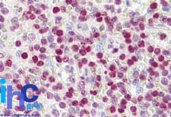 Histone H2AX Antibody, Novus Biologicals 0.1mg; Unlabeled:Antibodies, Polyclonal