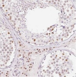 H2BFWT Antibody, Novus Biologicals:Antibodies:Primary Antibodies