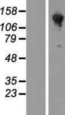 Novus Biologicals&trade;&nbsp;HA-1 Overexpression Lysate