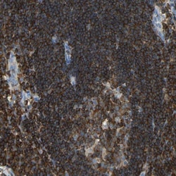 HA-1 Antibody, Novus Biologicals 25 &mu;L; Unlabeled:Antibodies, Polyclonal