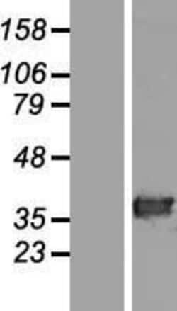 Novus Biologicals&trade;&nbsp;HAAO Overexpression Lysate