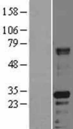 Novus Biologicals&trade;&nbsp;HABP2 Overexpression Lysate