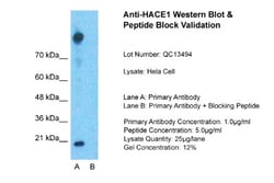 HACE1 Antibody, Novus Biologicals 0.05mg; Unlabeled:Antibodies, Polyclonal