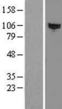 Novus Biologicals™ HACE1 Overexpression Lysate