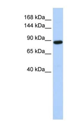 HACE1 Antibody, Novus Biologicals 0.05mg; Unlabeled:Antibodies, Polyclonal
