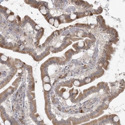 HPCL Antibody, Novus Biologicals 25 &mu;L, Unlabeled:Antibodies, Polyclonal