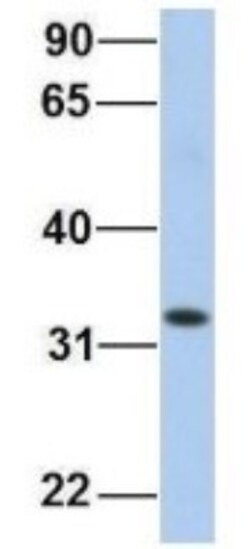 HADH Antibody, Novus Biologicals 100&mu;L; Unlabeled:Antibodies, Polyclonal