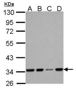 HADH Antibody, Novus Biologicals 0.1mL; Unlabeled:Antibodies, Polyclonal