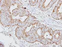 HADHA Antibody, Novus Biologicals 0.1mL; Unlabeled:Antibodies, Polyclonal