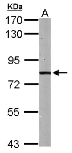 HADHA Antibody, Novus Biologicals 0.1mL; Unlabeled:Antibodies, Polyclonal